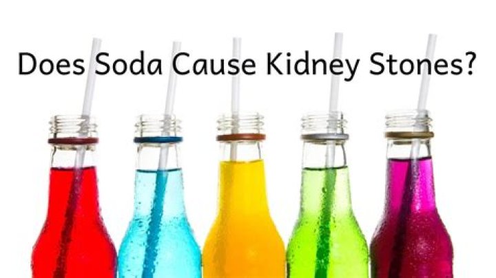 Carbonated Drinks Cause Kidney Stones, Researcher Says