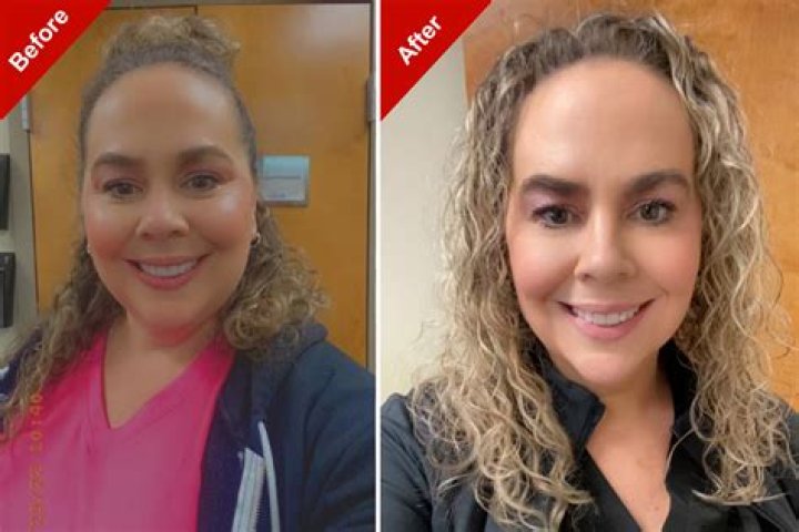  Has Abigail Rawlings had surgery? Before and after pics of Love Island star! Wed 21 July 2021 14:40 Updated Sat 7 August 2021 00:58 Celine Byford 