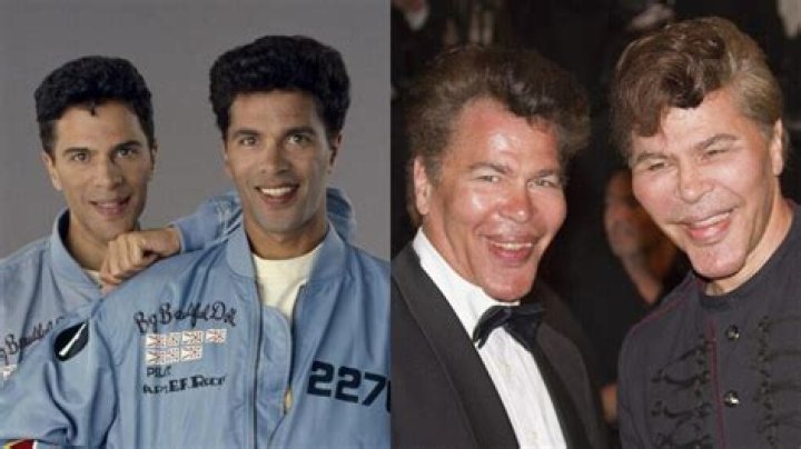 Igor And Grichka Bogdanoff Before Plastic Surgery