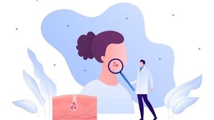 Los 5 motivos por los que merece la pena ir al dermatólogo