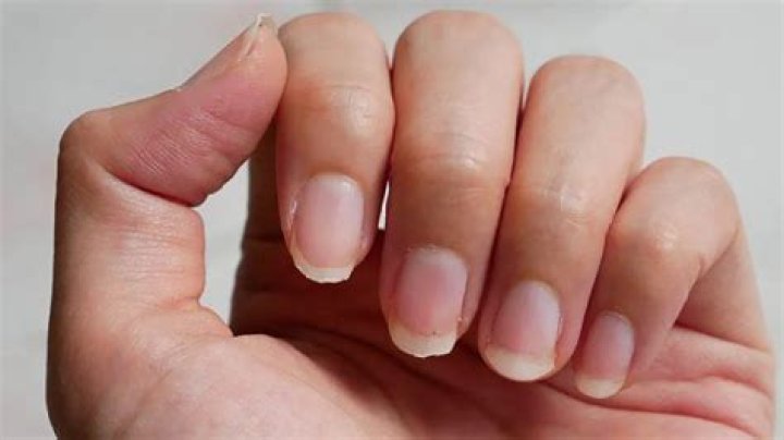 Mis uñas han cambiado de color, ¿es grave?