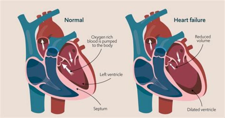 Schlesinger blamed heart failure on Madonna