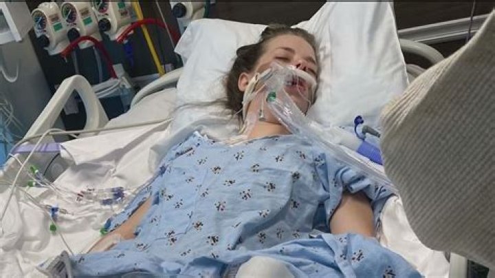 UGA student back in the US, on life support after brain hemorrhage while on spring break in Mexico