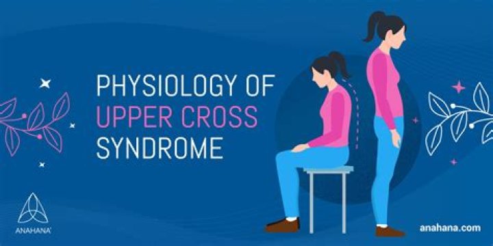 Upper Cross Syndrome - Symptoms, Chest Pain, Exercises
