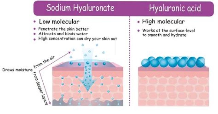 What Is Sodium Hyaluronate — and How Can It Benefit the Skin?